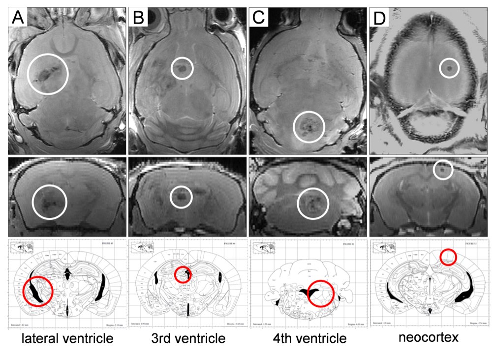 H4Fig. 4_Xanthomas in ApoEFbn1 mic eare mainly observed in the brain ventricles and in the neocortex, as shown by MRI