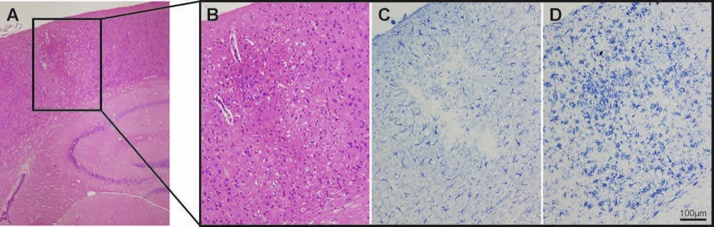 H5Fig 2_Infarct